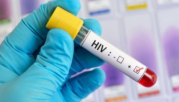 Estados Unidos: empezaron los ensayos de una vacuna contra el HIV en humanos