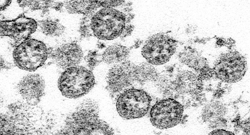 Según el CDC, había COVID en EEUU antes de lo pensado