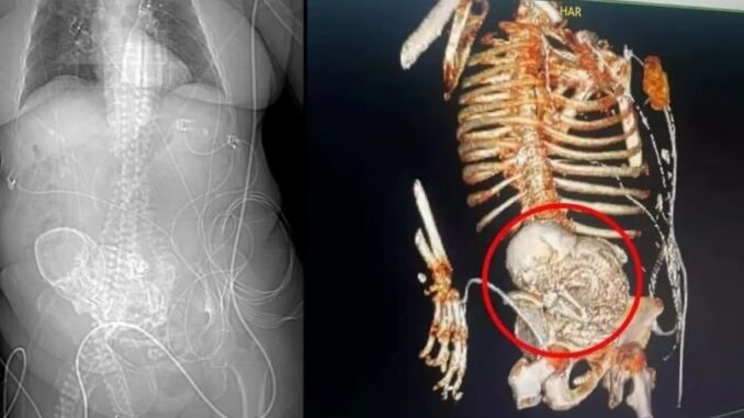 BEBE DE PIEDRA DESTACADA